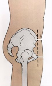 原来这个群体也会骨盆前倾!多动图示范自我矫正